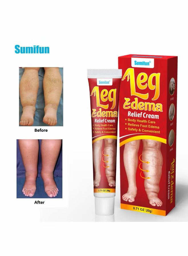 Leg Edema Cream,